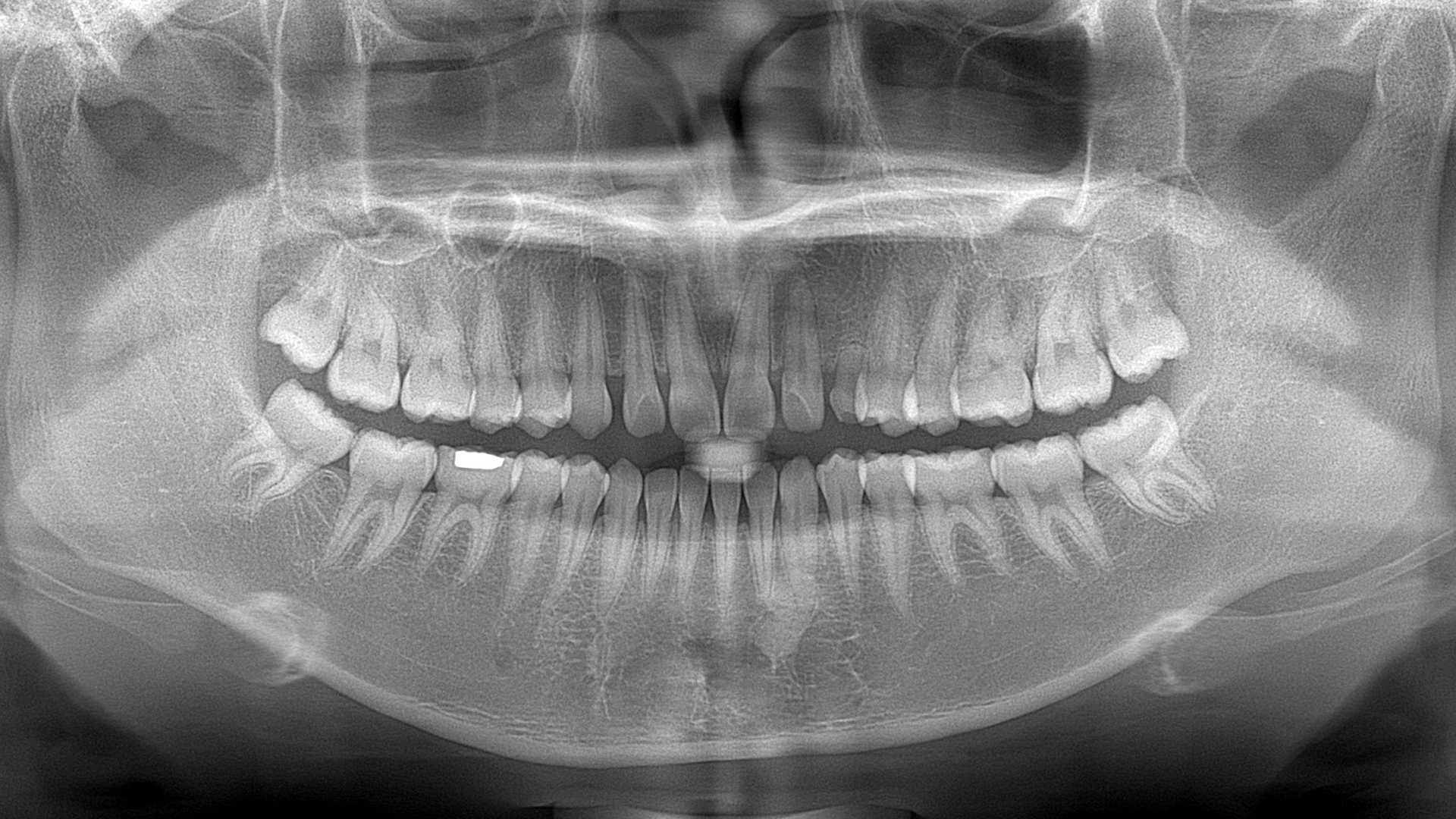 Glasgow Oral Surgery Symposium_Hero