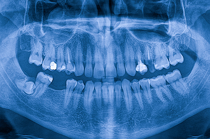 Dental Cone Beam 2A