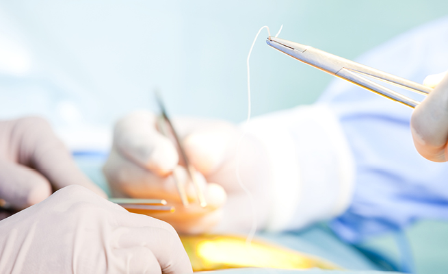 Surgeon stitching wound